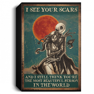 1.5'' Deluxe Canvas