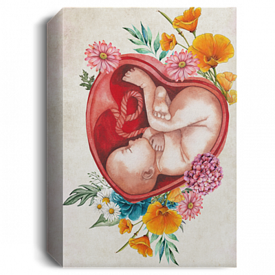 1.5'' Deluxe Canvas