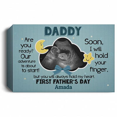 1.5'' Deluxe Canvas