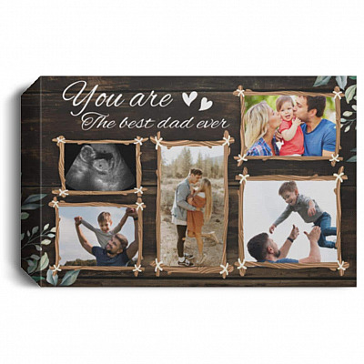 1.5'' Deluxe Canvas